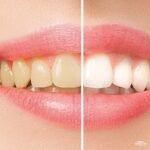 6db1cfa2e57d98e9fc056a93c57f93d8